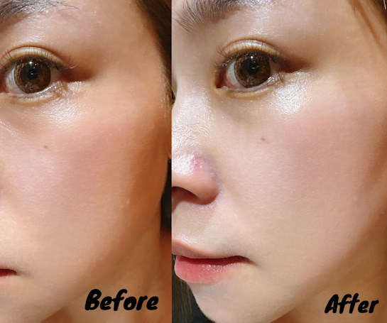 🌞微生平衡清爽物理防曬⭐️ 防曬神品