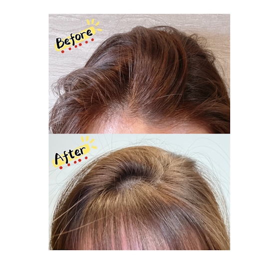 髮根UP UP 💖巴黎萊雅玻尿酸水光豐盈洗護