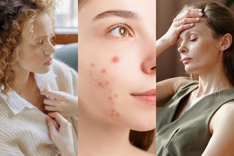 慢性發炎是什麼？出現這 10 個症狀代表身體正在默默燃燒！喉嚨痛、嘴破、長痘痘、臉部泛紅⋯⋯通通都是警訊！