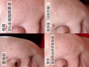 【寶拉珍選高效胜肽膠原緊緻霜，打造澎潤蘋果肌，讓職場媽咪效率保養、上妝即發光！✨】