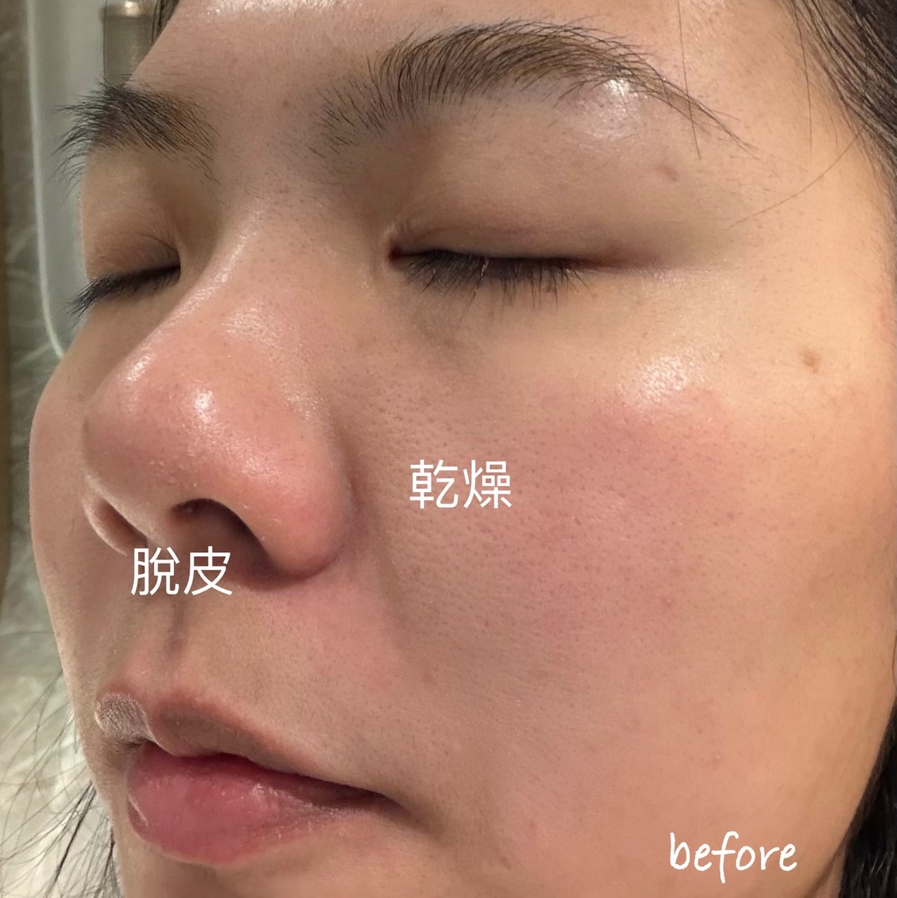 我的出國法寶：CeraVe適樂膚全效水光B5玻尿酸修護精華！